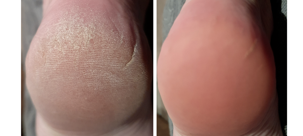 pedi 2 1000x450